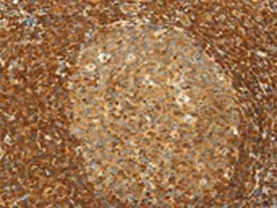 SLC6A3 Antibody