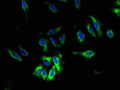 SLC6A6 antibody