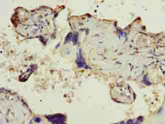 SLC6A6 Antibody