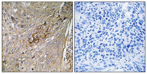 SLC6A6 Antibody