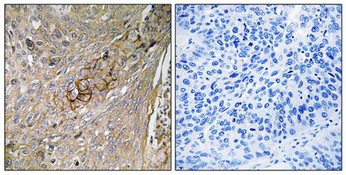 SLC6A6 antibody