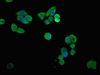 SLC6A8 Antibody