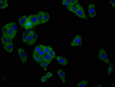 SLC7A1 Antibody