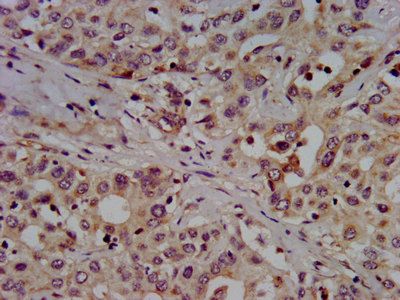 SLC7A1 Antibody