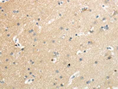 SLC7A11 Antibody