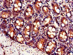 SLC7A6 Antibody
