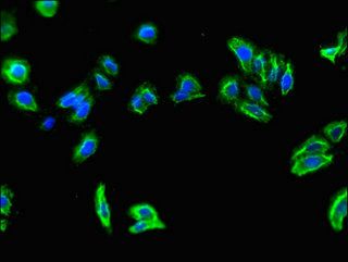 SLC7A7 Antibody