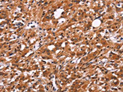 SLC8A2 antibody