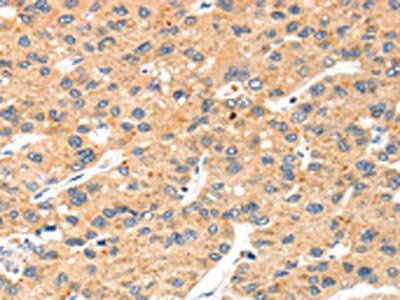 SLC8B1 Antibody