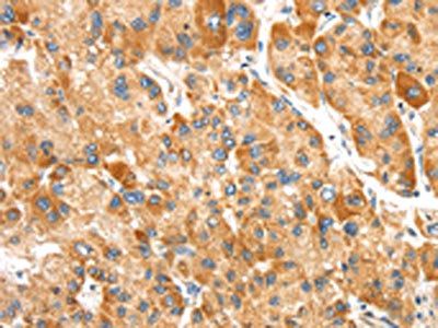 SLC8B1 antibody