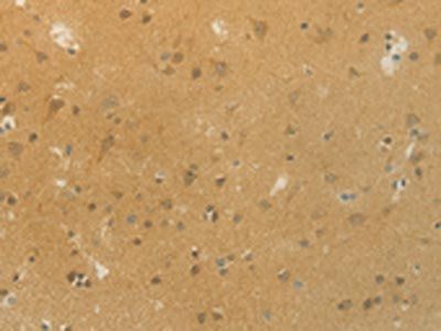 SLC9A3 Antibody