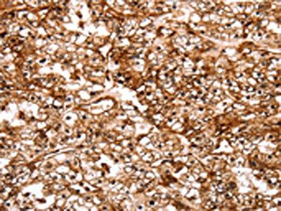 SLC9A3R2 antibody