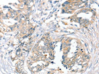 SLC9A9 Antibody
