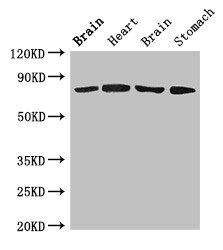 SLCO1B1 Antibody