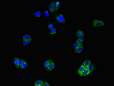 SLCO1B3 Antibody