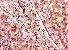 SLCO1B3 Antibody