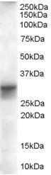 SLIMMER/FHL1 isoform B Antibody
