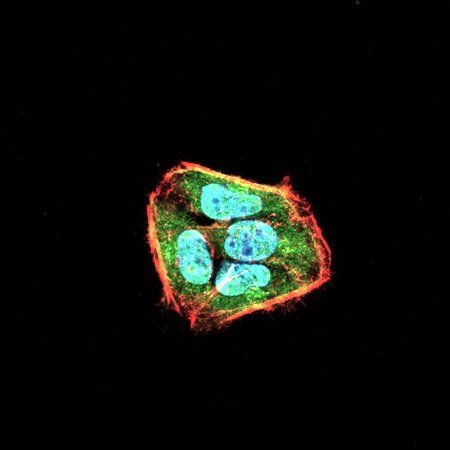 SLINGSHOT-1L Antibody