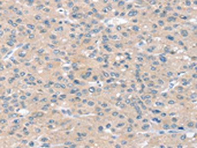 SLIT2 Antibody