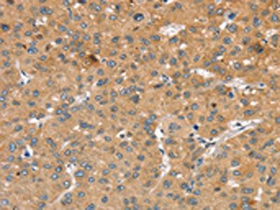 SLIT2 Antibody