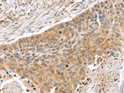 SLIT3 Antibody