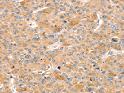 SLIT3 Antibody