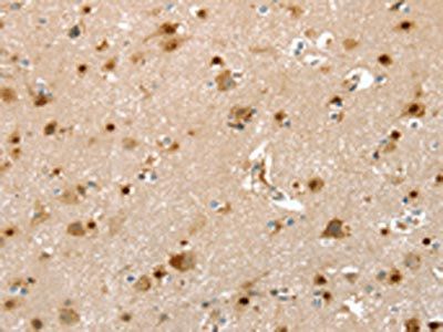 SLIT3 Antibody