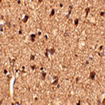 Slitrk1 Antibody