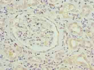 SLITRK4 Antibody