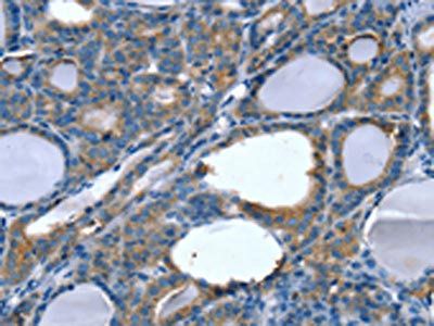 SLITRK4 Antibody