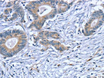 SLITRK4 Antibody