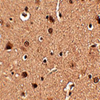 Slitrk4 Antibody