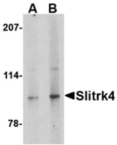 Slitrk4 Rabbit Polyclonal Antibody