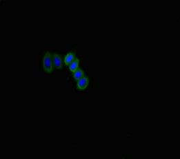 SLITRK6 antibody
