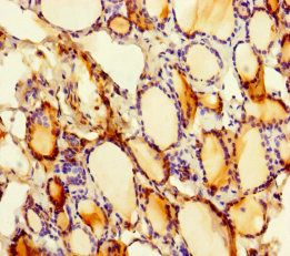 SLITRK6 Antibody