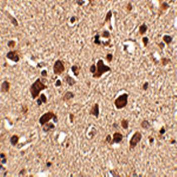 Slitrk6 Rabbit Polyclonal Antibody