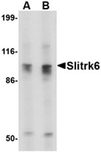 Slitrk6 Rabbit Polyclonal Antibody
