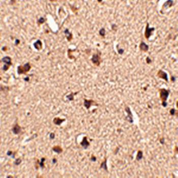 Slitrk6 Rabbit Polyclonal Antibody