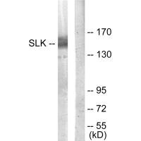 SLK antibody