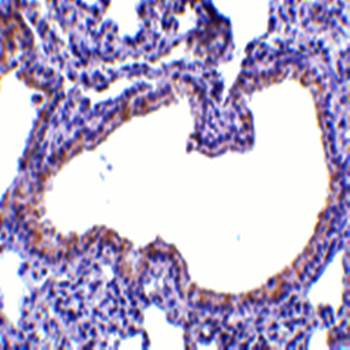 SLPI Rabbit Polyclonal Antibody