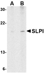 SLPI Rabbit Polyclonal Antibody