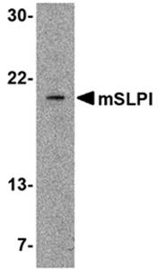 SLPI Rabbit Polyclonal Antibody