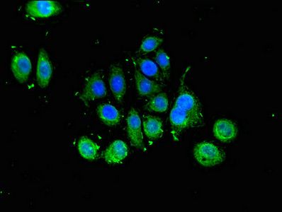 SLU7 antibody