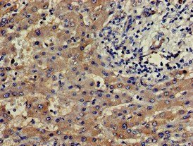 SLU7 Antibody