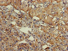 SLU7 Antibody