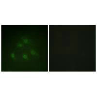 SMAD1 Antibody
