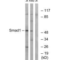 SMAD1 Antibody