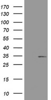 SMAD1 Antibody