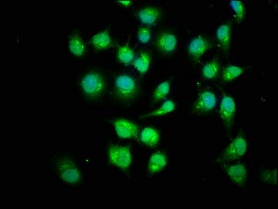 SMAD1 Antibody
