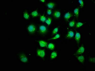 SMAD1 antibody